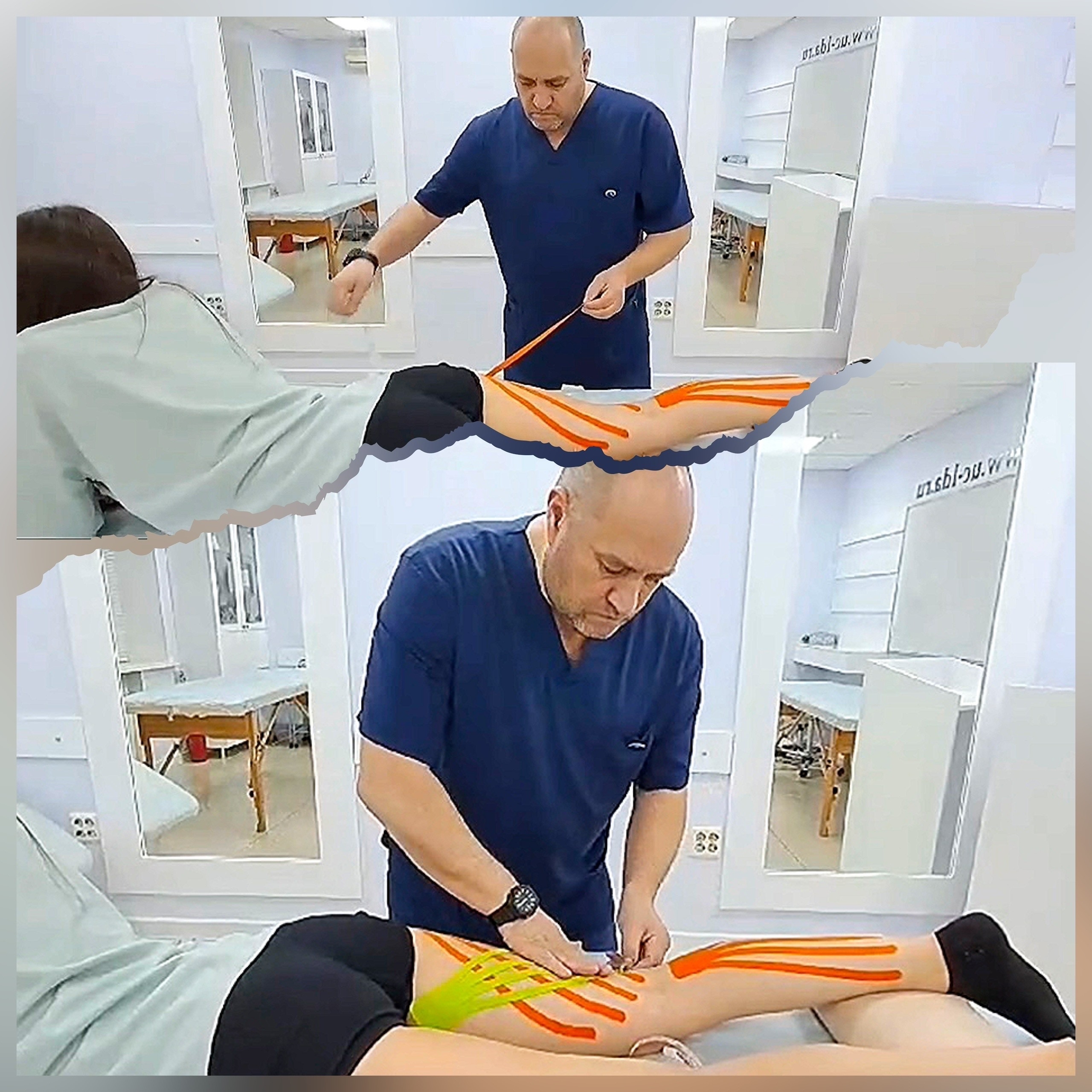 Кинезиотейпирование